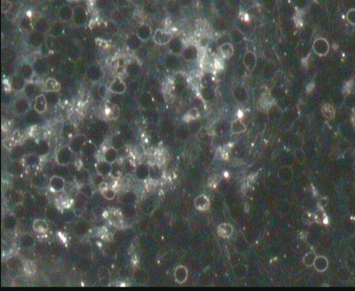 Stanice duhovi (ghost cells) pod mikroskopom